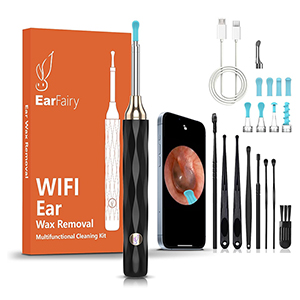 EarFairy Ohrenschmalz Entferner Otoskop für nur 9,83€ – Prime